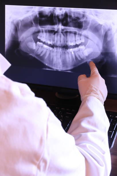 Best Emergency Treatment for Oral Infections in Pasatiempo, CA