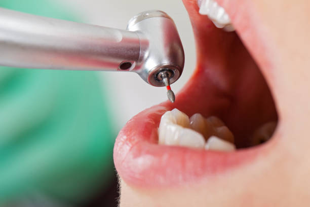 Best Emergency Denture Repair in Pasatiempo, CA